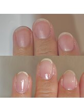 フェミニンネイル(Feminine Nail)/