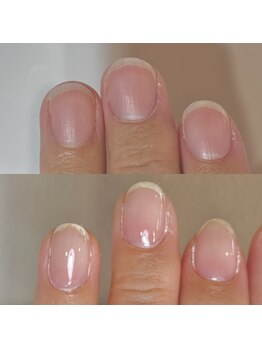 フェミニンネイル(Feminine Nail)/
