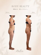 メリア(Mellia)