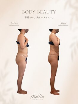 メリア(Mellia)の写真/体重ではなく、体型を変える。骨格から整える大人のボディメイク【chino THE METHOD Body】