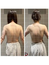 ロッタ エクリュ(Lotta ecru+)/背中を綺麗に魅せるマッサージ