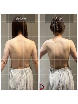 ロッタ エクリュ(Lotta ecru+)/背中を綺麗に魅せるマッサージ