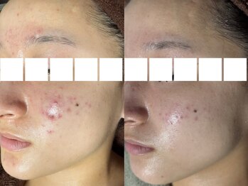 リボーン(REBORN)/人気No.1