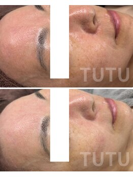 チュチュ(TUTU)/クリスティーナ　イラストリアス