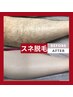 【清潔感UP×長期間効果持続】メンズ全身脱毛★夏集中コース／返金保証つき！