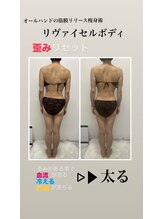 シャルム(Charme)/リヴァイセルボディ