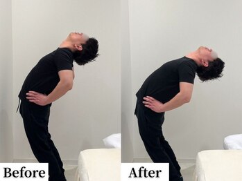 ソレア(Solea)/骨盤の歪み・腰痛改善1回目