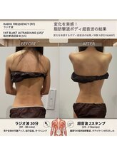 ミリュール(Millule)/