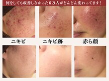 アクール(Accueil)