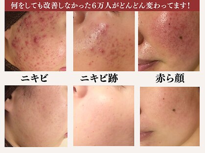 アクール(Accueil)の写真