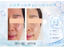 ユアーズ ビューティー(YOURS beauty)/ハイアールチューン