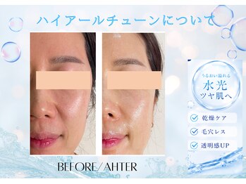ユアーズ ビューティー(YOURS beauty)/ハイアールチューン