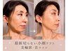 【たるみ｜くすみ｜シワ】糸リフト級に引き上げる 最先端美輪郭小顔術90分