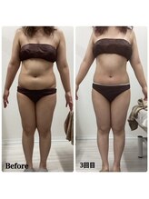 ルピア(L'pur)/全身痩せ★