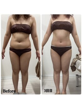 ルピア(L'pur)/全身痩せ★