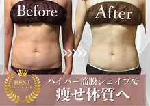 チャンティック(Cantik)