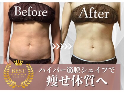 チャンティック(Cantik)の写真