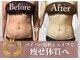 チャンティック(Cantik)の写真