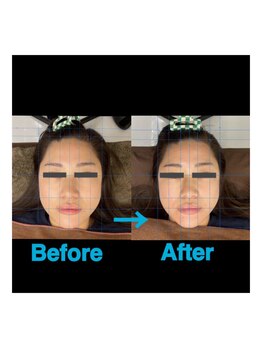 日進町整体院/30代女性　初回から効果実感