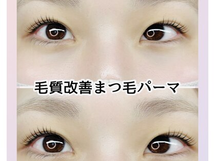 ナナラ(nanara)の写真