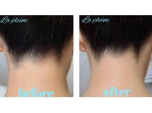 ラプレーヌ(La pleine)/うなじ脱毛