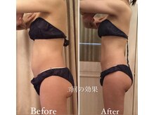 ローズボーテ(ROSE BEAUTE)の雰囲気（結果重視の圧倒的技術力！全員がスペシャリスト）