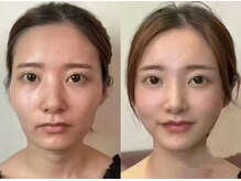 楽だの雰囲気（新中式小顔は、骨格、筋肉、筋膜の3次元で包括的にアプローチ）