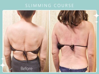 ハノハノ 八代店(HANO HANO)/選べる12種の痩身脂肪撃退☆