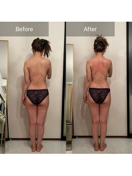 ルネアススパ 南青山(Lune’as Spa)/《WINBACK》 痩身