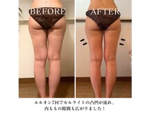 ヨサパーク サンテ 祐天寺(YOSA PARK sante)の雰囲気(痩身/ダイエット/ハーブ蒸し/水素/リンパマッサージ/ブライダル)