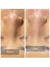 グリーンノート(GREEN NOTE)/光エステと脱毛！