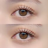 ブリンクアイ(blink eye)