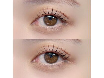 ブリンクアイ(blink eye)の写真
