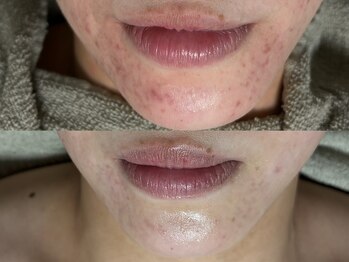 リボーン(REBORN)/ゆらぎ肌こそハーブ