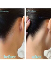 ラプレーヌ(La pleine)/うなじ脱毛