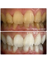 ホワイトニングルーム 横浜店(Whitening Room)/セルフホワイトニング/横浜