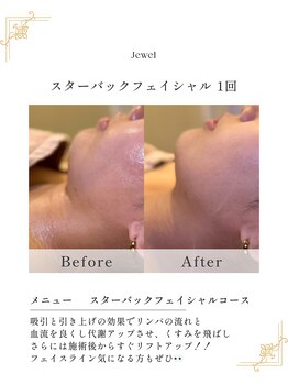 スパジュエル(SPA JEWEL)/