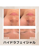 チェンジ(Change)/