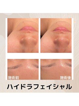 チェンジ(Change)/