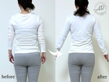 エーアール(AR)の写真/【ムダ肉、実は「歪んだ骨格」のせい】痩せにくい二の腕・知らぬ間に積もった背肉を撃退！