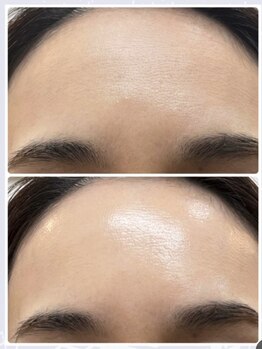 サリュ 行徳店(Salut)/驚きのツヤ肌!!!