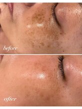 グレイス/最新光フォト