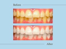 ルアナ(Luana)/Specialメニュー施術例