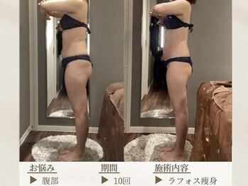 ベレガ 京都店(BELEGA)/◆beforeafter◆