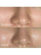 エメリーヌ(AIMELINE)/艶肌WAX +アンストレスマスク