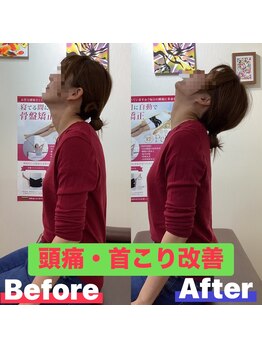 ヒデ整体院(Hide整体院)/猫背矯正骨盤矯正B/A肩こり腰痛