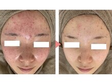 スリリアン 銀座/★お客さまビフォーアフター★