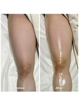 コア(Coeur)/befor→after