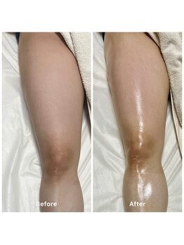 コア(Coeur)/befor→after