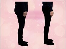 たけ整骨院/47歳美魔女　美脚獲得